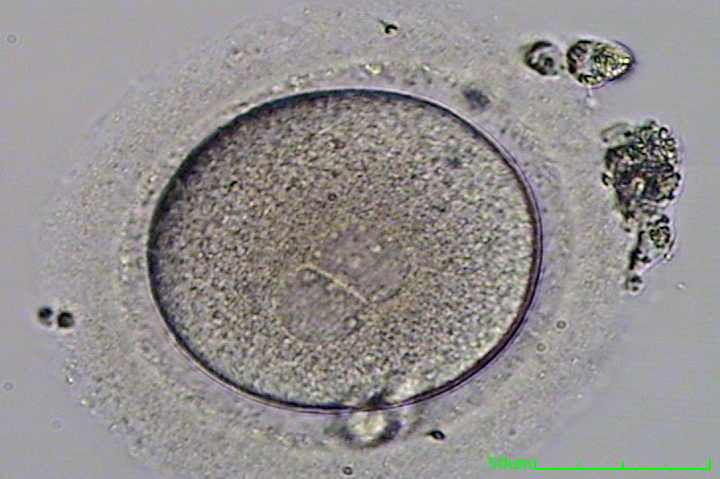 Fertilized egg with polar body