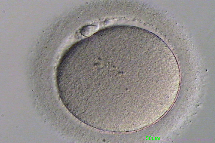 Ivf Process Step By Step Egg Retrieval Embryo Transfer Austin Ivf