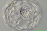 expanded-blastocyst