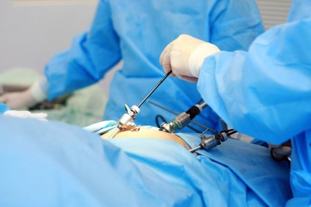 Conditions Treated by Fertility Surgery