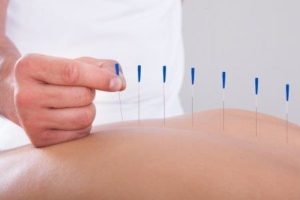 Find out whether there’s value in pairing acupuncture with IVF